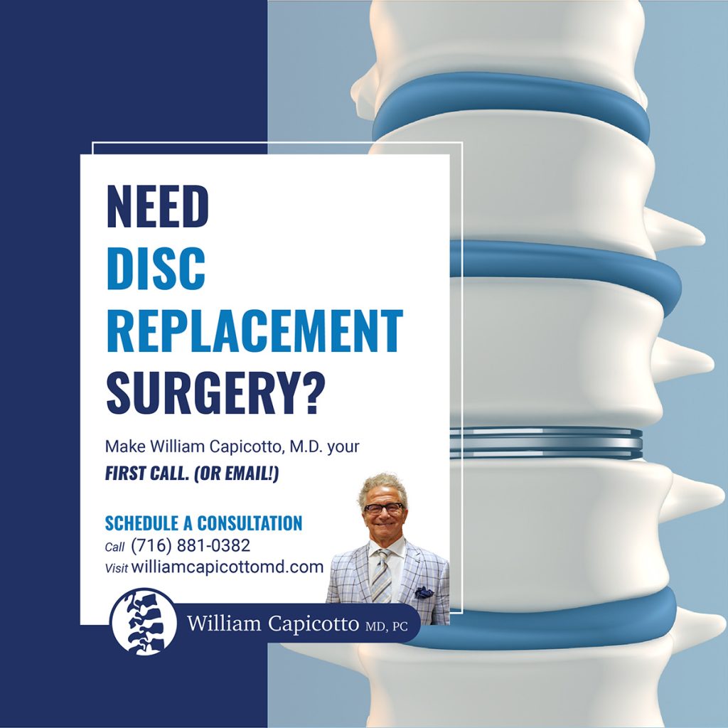 When you have a limited range of motion because of a damaged disc and non-surgical options no longer alleviate the pain, turn to an experienced spine surgeon like Dr. William Capicotto MD for exceptional disc replacement surgery.