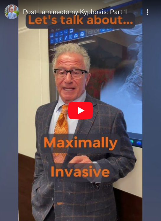 Let's talk about Post Laminectomy Kyphosis. Here's a sneak peek into your favorite minimally invasive spine surgeon's problem solving!
