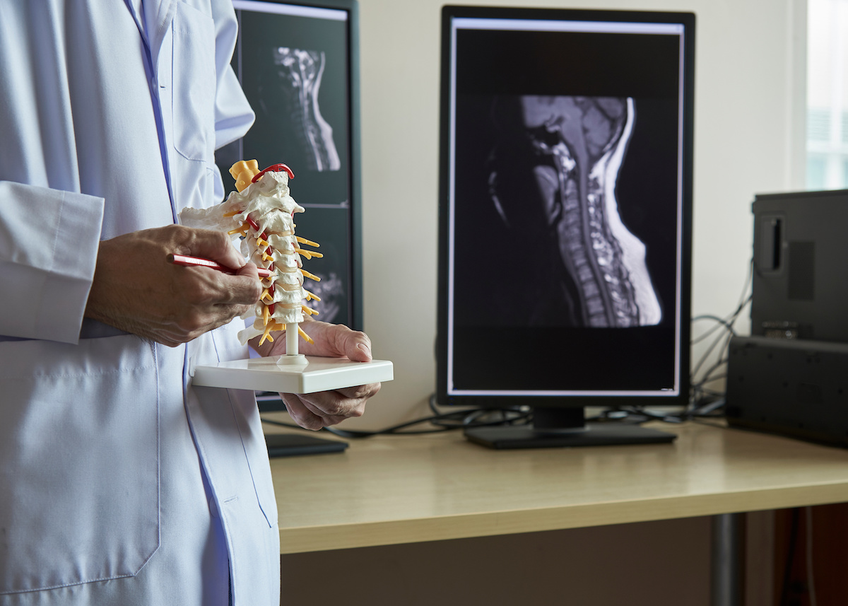 Read more about the article Myths About The Spine