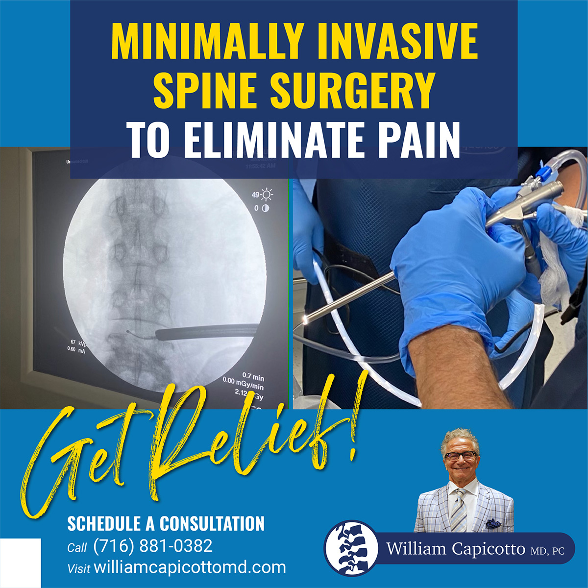 At William Capicotto MD we use the latest technology and state-of-the-art equipment to perform minimally invasive spine surgery.