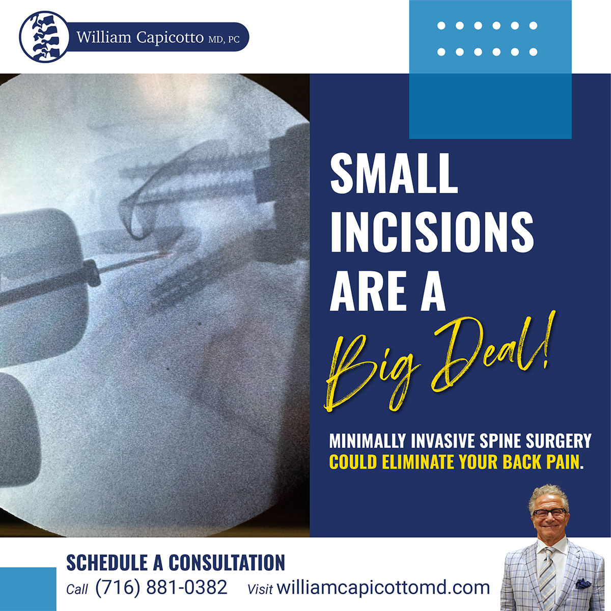 As the first spinal surgeon in Western New York to be certified in endoscopic spine surgery, we believe that small incisions are a BIG DEAL.