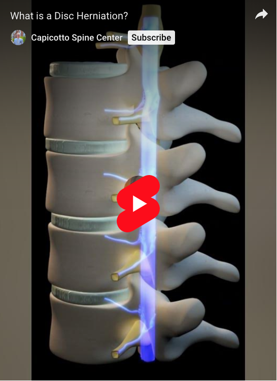 Take a moment to learn about your spine and disc herniation – it could be the source of your back or neck pain.