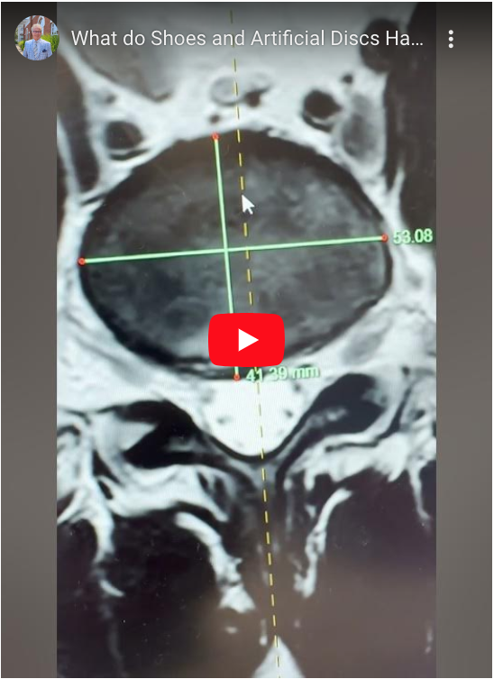 What do shoes and artificial discs have in common? You have to measure to make sure they fit properly!