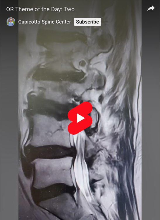 Precision and care in every surgical procedure. The theme of the day is TWO. | William Capicotto, spine surgeon in Buffalo, NY.