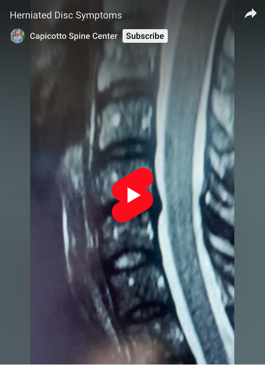 Depending on the location, you can experience a range of herniated disc symptoms.