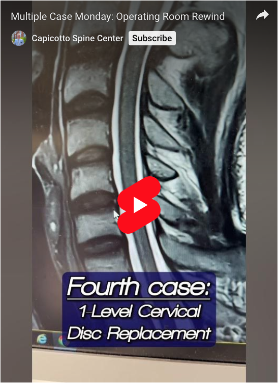 Read more about the article Multiple Case Monday: Operating Room Rewind