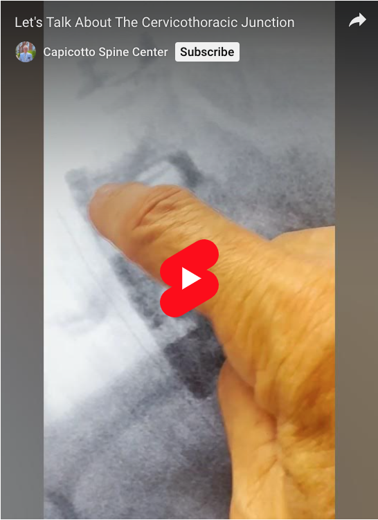 Read more about the article Let’s Talk About The Cervicothoracic Junction