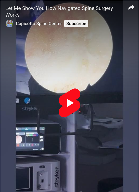Read more about the article Let Me Show You How Navigated Spine Surgery Works