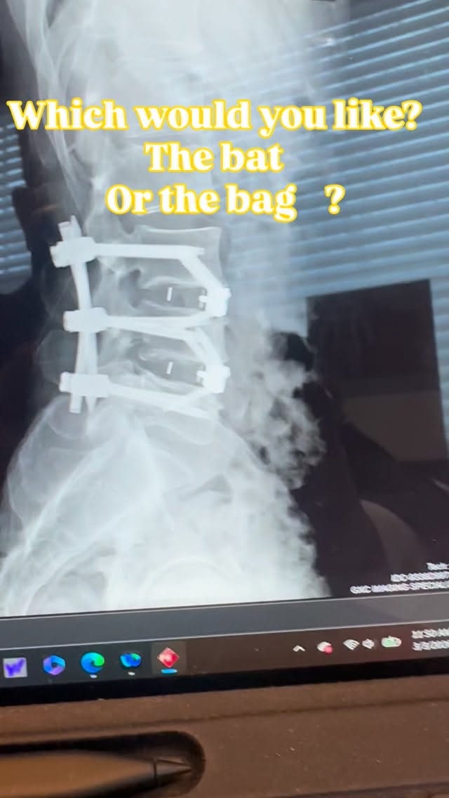 Read more about the article For you, Ray Donovan fans, what would you like the bat or the bag?