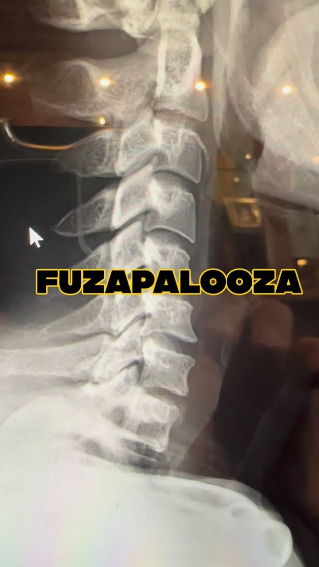 Read more about the article For my fusion friends