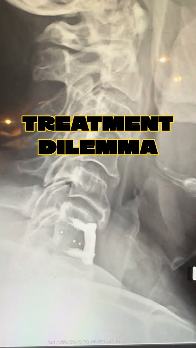 Read more about the article In my opinion, modern technology allows a continuum of treatment