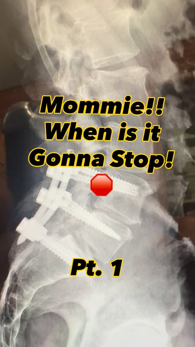 Read more about the article A fusion gets another fusion