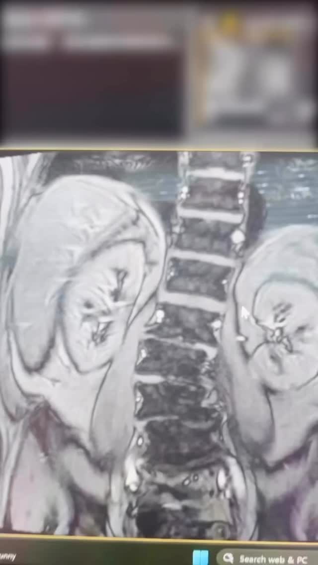 Read more about the article Patients are waking up