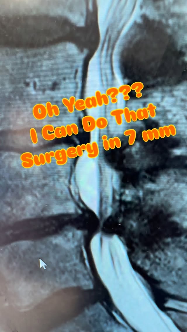 Oh Yeah??? I Can Do That Surgery in 7mm