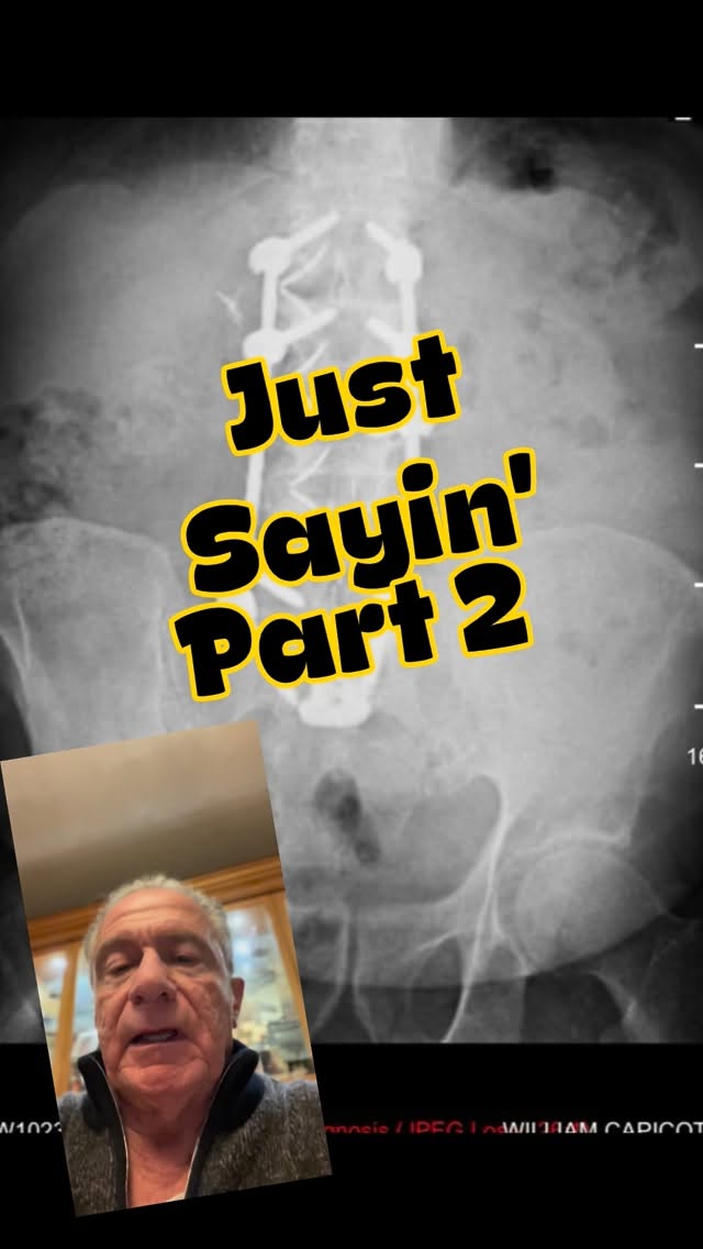 Read more about the article The sacroiliac joints are at risk for painful degeneration when they are adjacent to a long spinal fusion.
