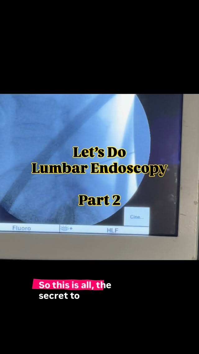 Ultra minimally, invasive lumbar spine surgery