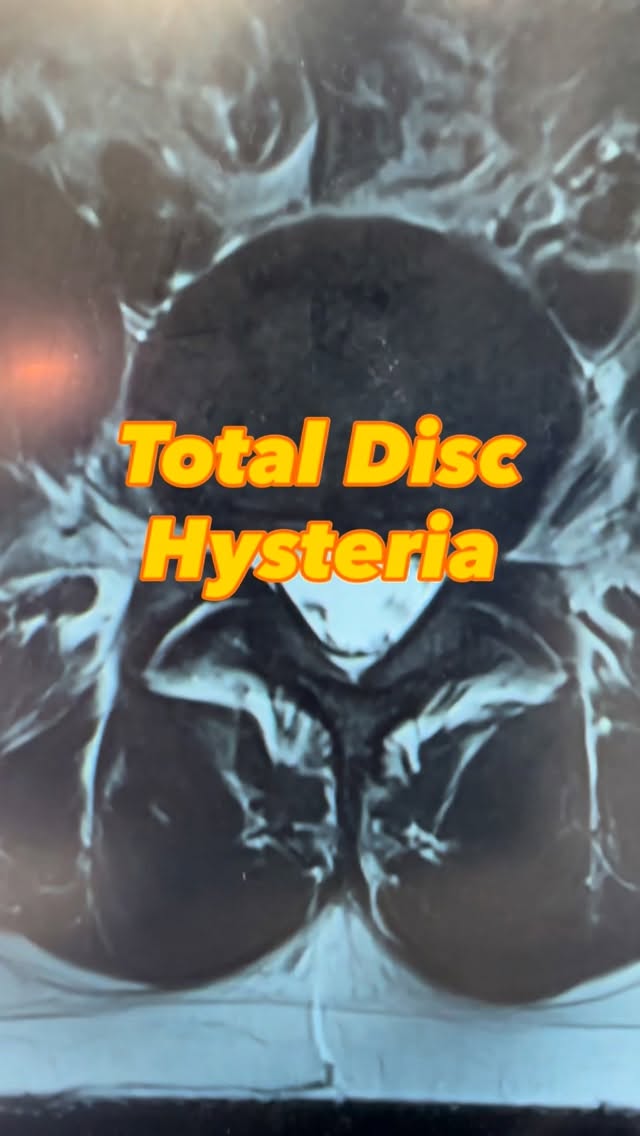 Read more about the article Total Disc Hysteria