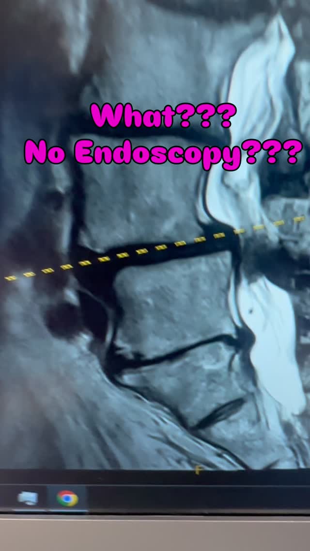 What??? No Endoscopy???